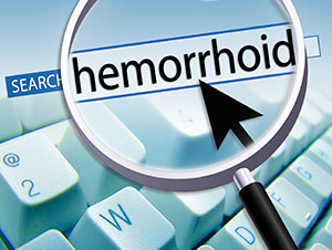 Topical steroids for hemorrhoids