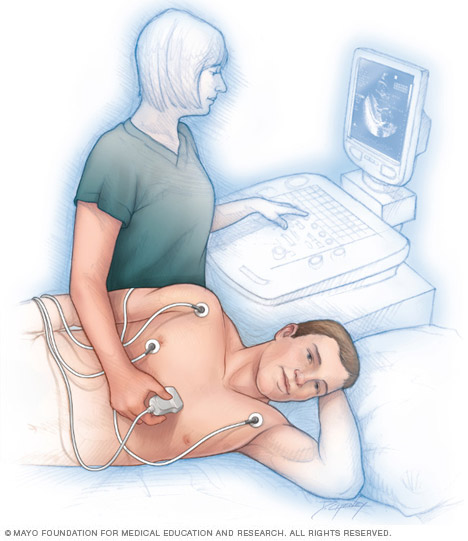 Echocardiogram