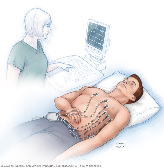 Elektrocardiogram