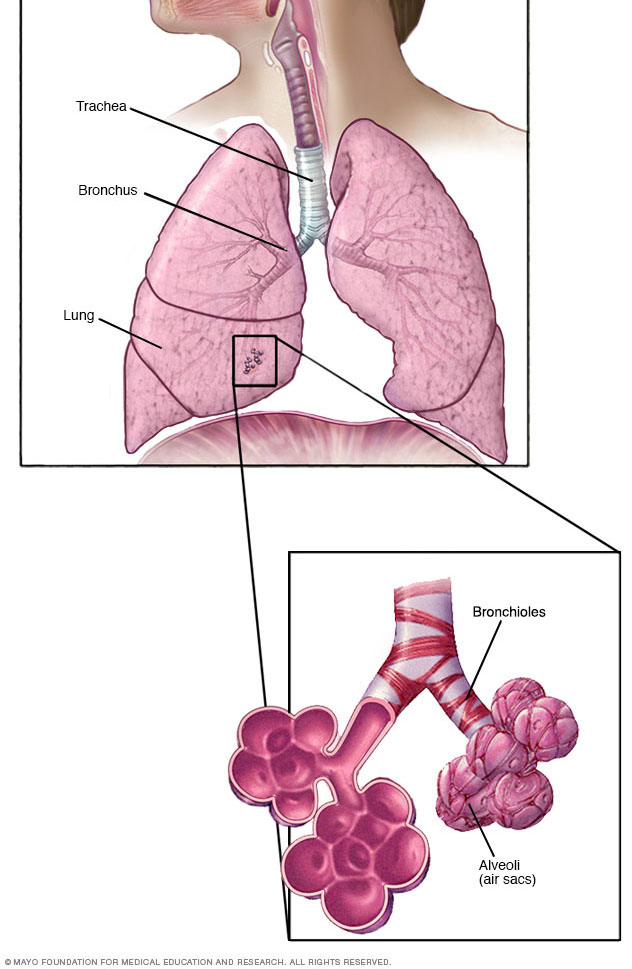 Bronquiolos y alvéolos en los pulmones.