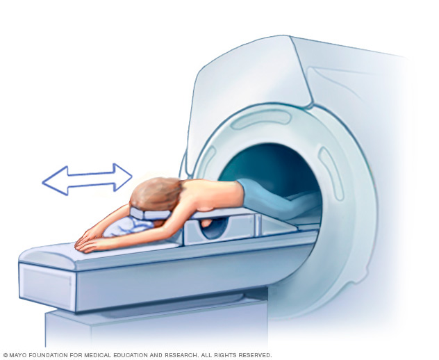 Prsa MRI