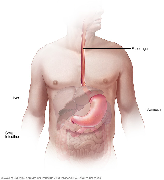 Simptome și cauze ale cancerului esofagian