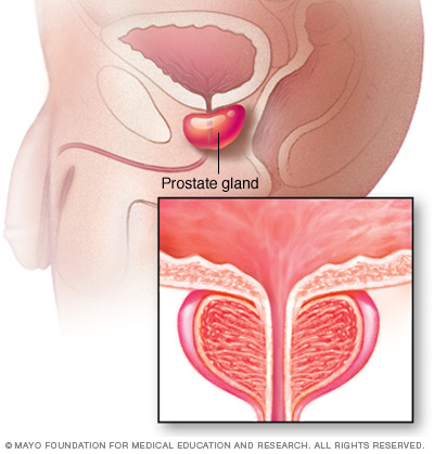 Prostatadrüse