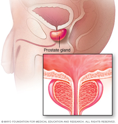 Prostata kjertel