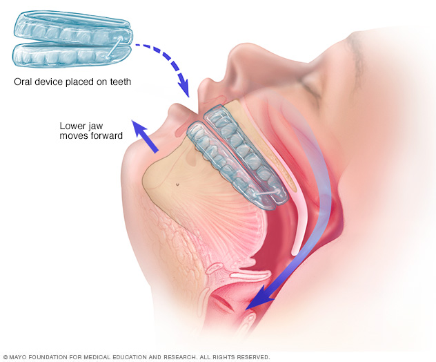 Dispositif oral