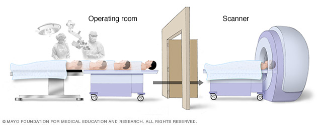 Intraoperative MRT