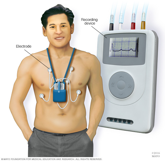 Holter-monitor