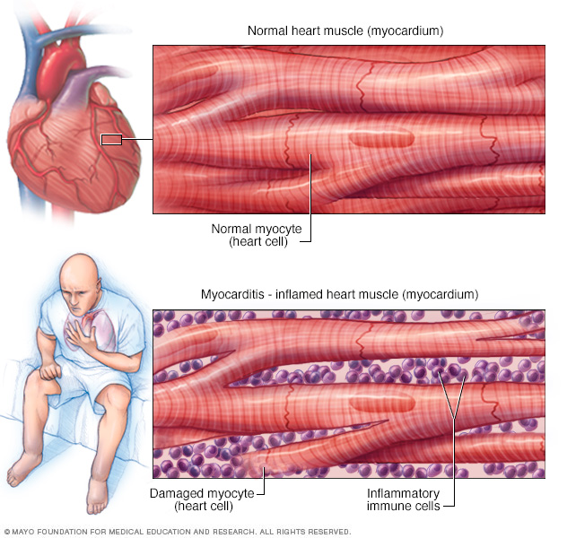 your heart is a muscle book your heart is a muscle book