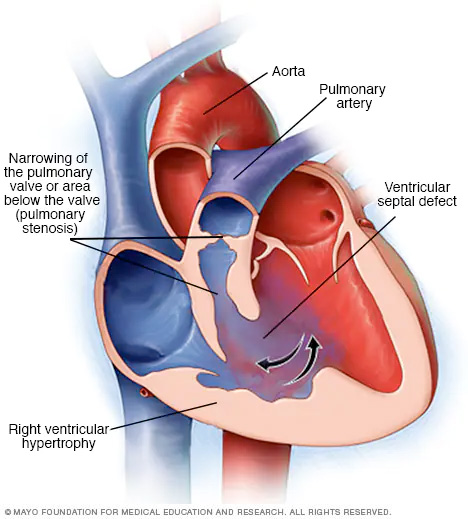 Heart chamber anatomy PI - UpToDate