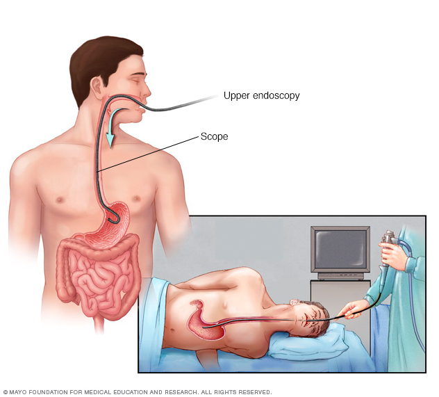 Endoscopie