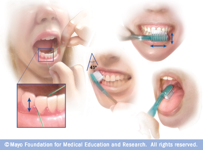 Dental Health Insurance