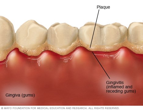 Dental Health