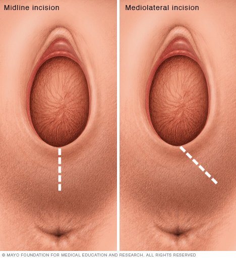 Gag jizz deepthroat Sore in anus for a year - cancer