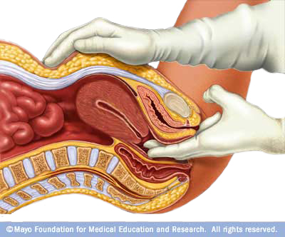 vaginal exam Deep