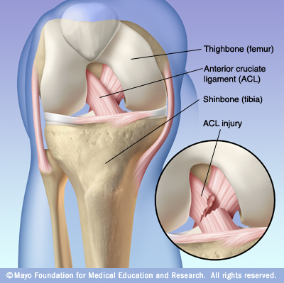 acl injury acl injury