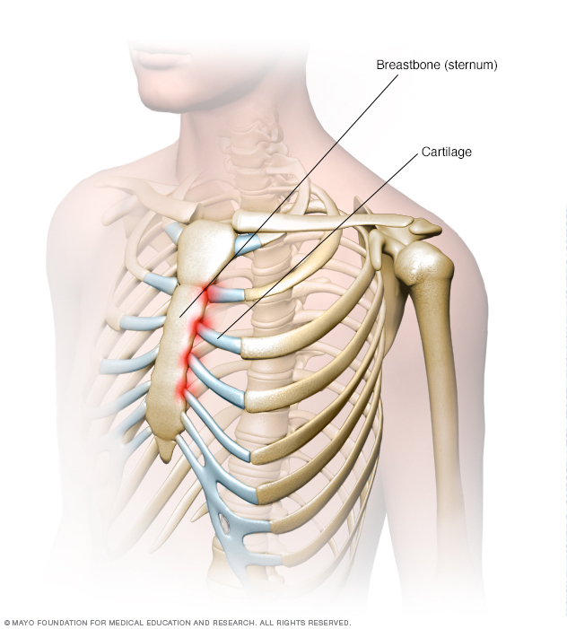 Conditions When Breast Bone Meets Ribs Black Ametuer Sex