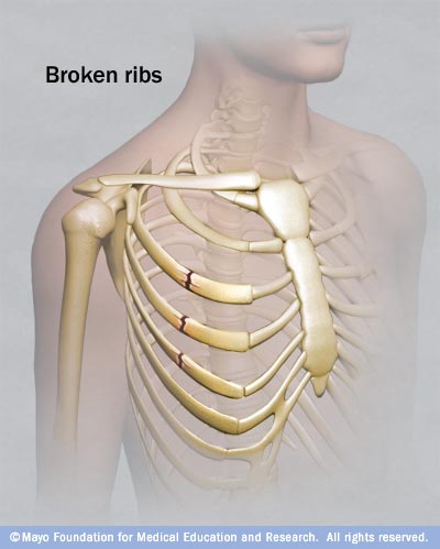 ribcage get it done