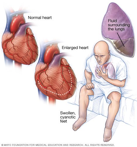 What are some symptoms of weak heart muscles?