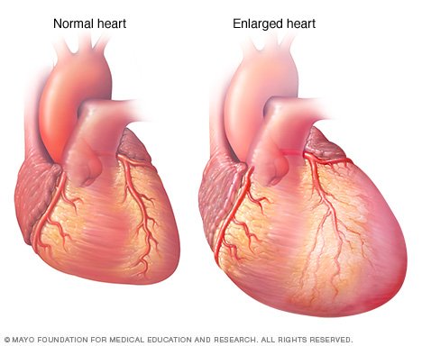 What Does Drinking Alcohol Do To Your Lungs What Does Drinking Alcohol Do To Your Lungs