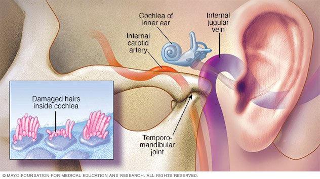 which drugs cause ringing in the ears