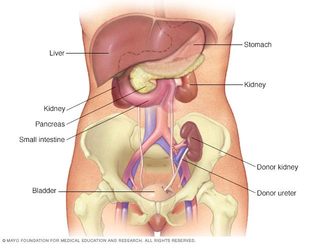 Ha egy kő van az ureterben, a cystitis jelei lehetnek