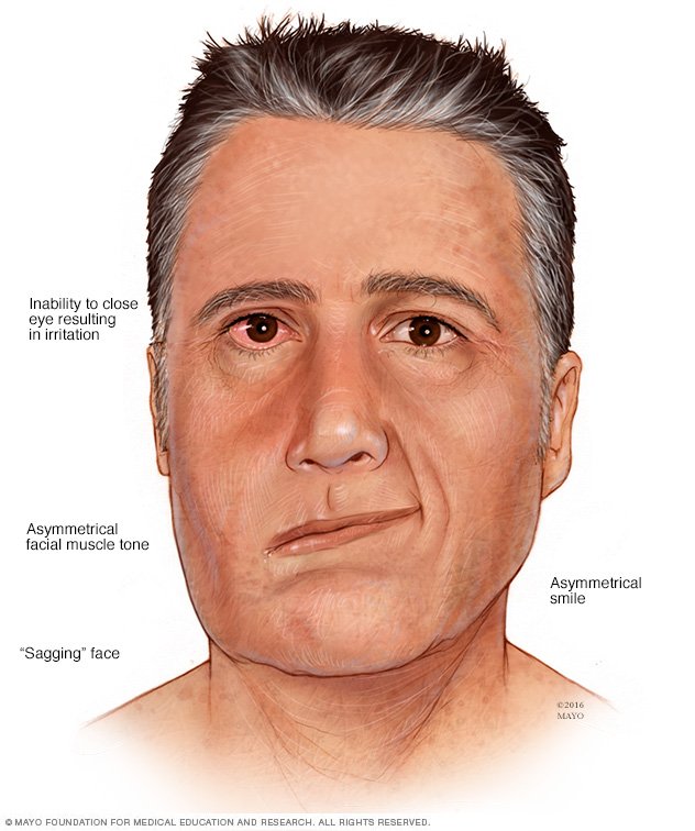 ramsay-hunt-syndrome-disease-reference-guide-drugs