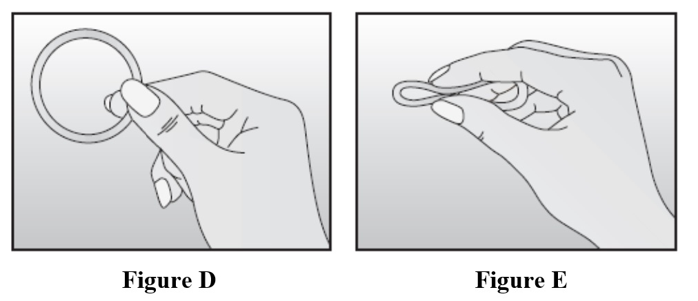 Rings and Rods (Nuvaring and Nexplanon): Kirstie Cunningham, MD, FACOG,  NCMP: OB-GYN