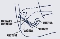 Miconazole Image 3