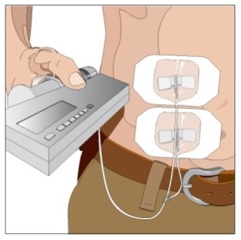 Figure 12