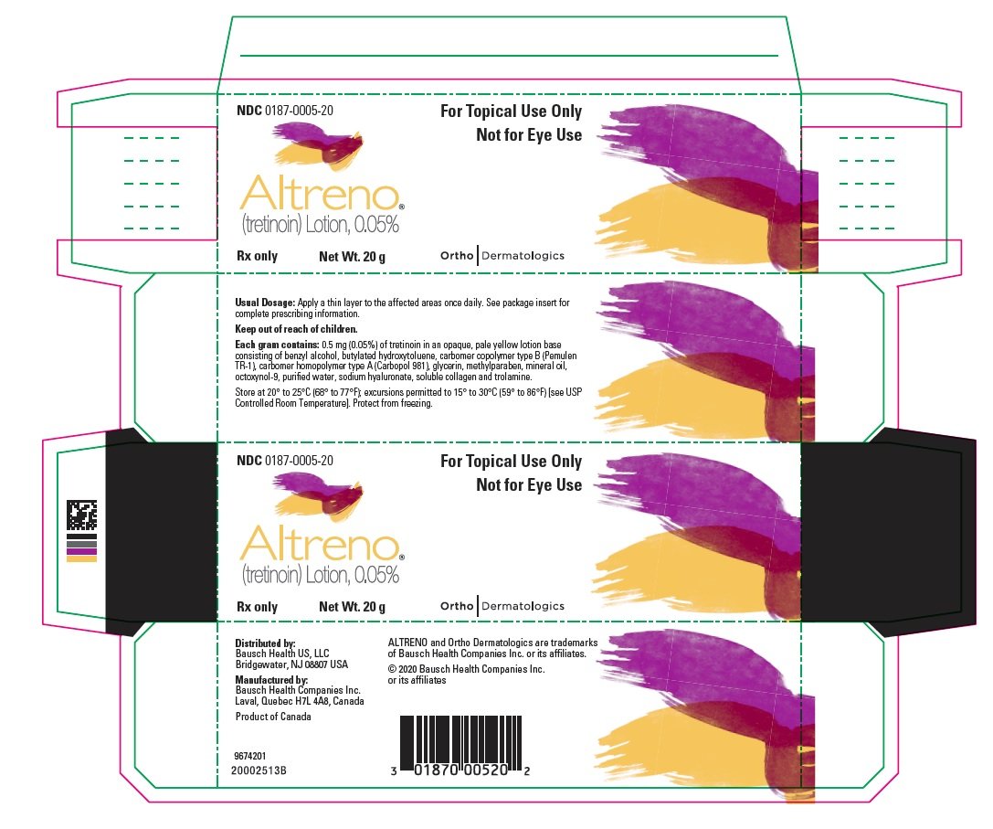 Ciprofloxacin prescription