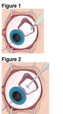 figures 1 and 2