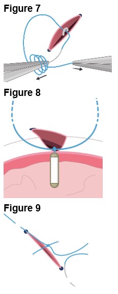 figures 7-9