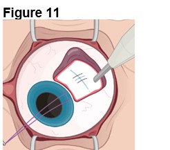 Figure 11