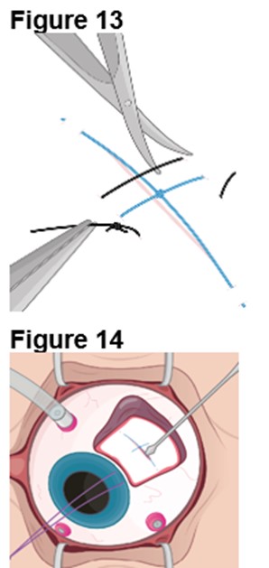 Figures 13 and 14