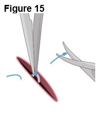 Figure 15