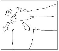 Figure B