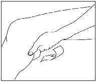 Figure C