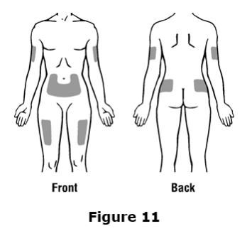 Do not inject Epogen into an area that is tender, red, bruised, hard, or has scars or stretch marks.  Recommended sites for injection are shown in Figure 11 below, including:
○ The outer area of the upper arms 
○ The abdomen (except for the 2-inch area around the navel)
○ The front of the middle thighs
○ The upper outer area of the buttocks
