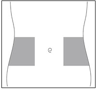 Figure E