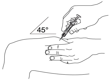 Figure F