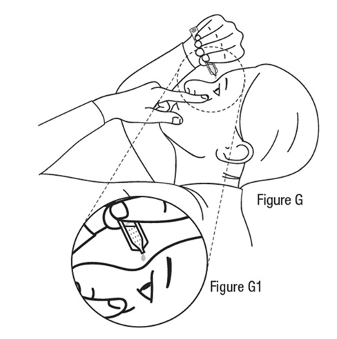 Figure G1