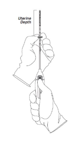 Setting Flange