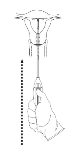 Funda Position