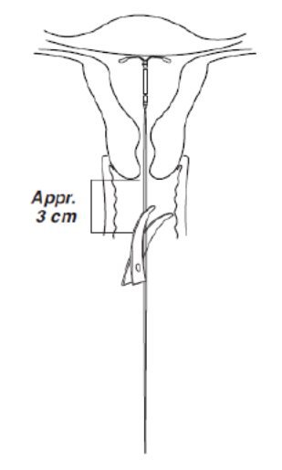 Cutting Threads