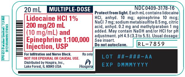 How long does lidocaine stay in your system? - proquestyamaha.web.fc2.com