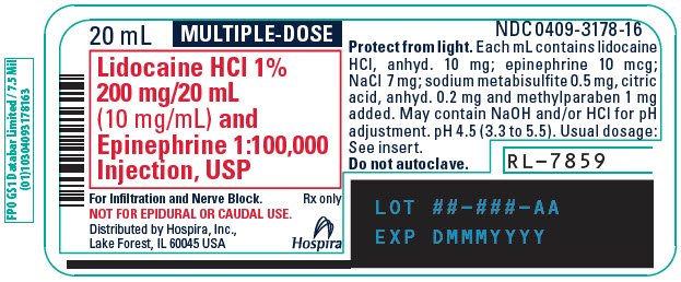 How long does lidocaine stay in your system?