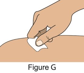 Figure G