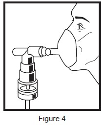 figure-4