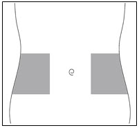Figure E