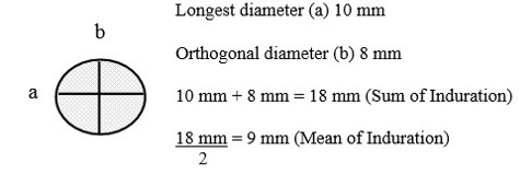 area-of-induration